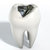 Tooth With Lead Filling stock photo © albund