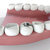 Teeth With Lead Filling stock photo © albund