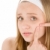 acne · adolescente · donna · brufolo · bianco - foto d'archivio © CandyboxPhoto