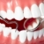 dentes · saudável · humanismo · dentista · boca · espelho - foto stock © Kurhan