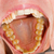 tandheelkundige · macro · shot · oppervlak · goed · zichtbaar - stockfoto © Lighthunter