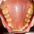 Dental photograpy stock photo © Lighthunter