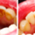 behandeling · tanden · twee · foto's · tandarts · een - stockfoto © Lighthunter