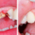tanden · wortel · behandeling · medische · aandacht · geneeskunde - stockfoto © Lighthunter