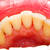 menselijke · tanden · gezondheid · geneeskunde · tand · tandheelkundige - stockfoto © Lighthunter