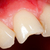 tanden · tand · tandheelkundige · behandeling · mijn · portefeuille - stockfoto © Lighthunter
