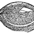 Eye with Vesicular or Pustular Keratitis, vintage engraving stock photo © Morphart