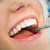 bocca · primo · piano · paziente · blu · dentista - foto d'archivio © pressmaster